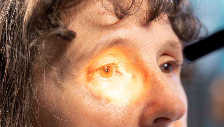 Diabetes e saúde dos olhos