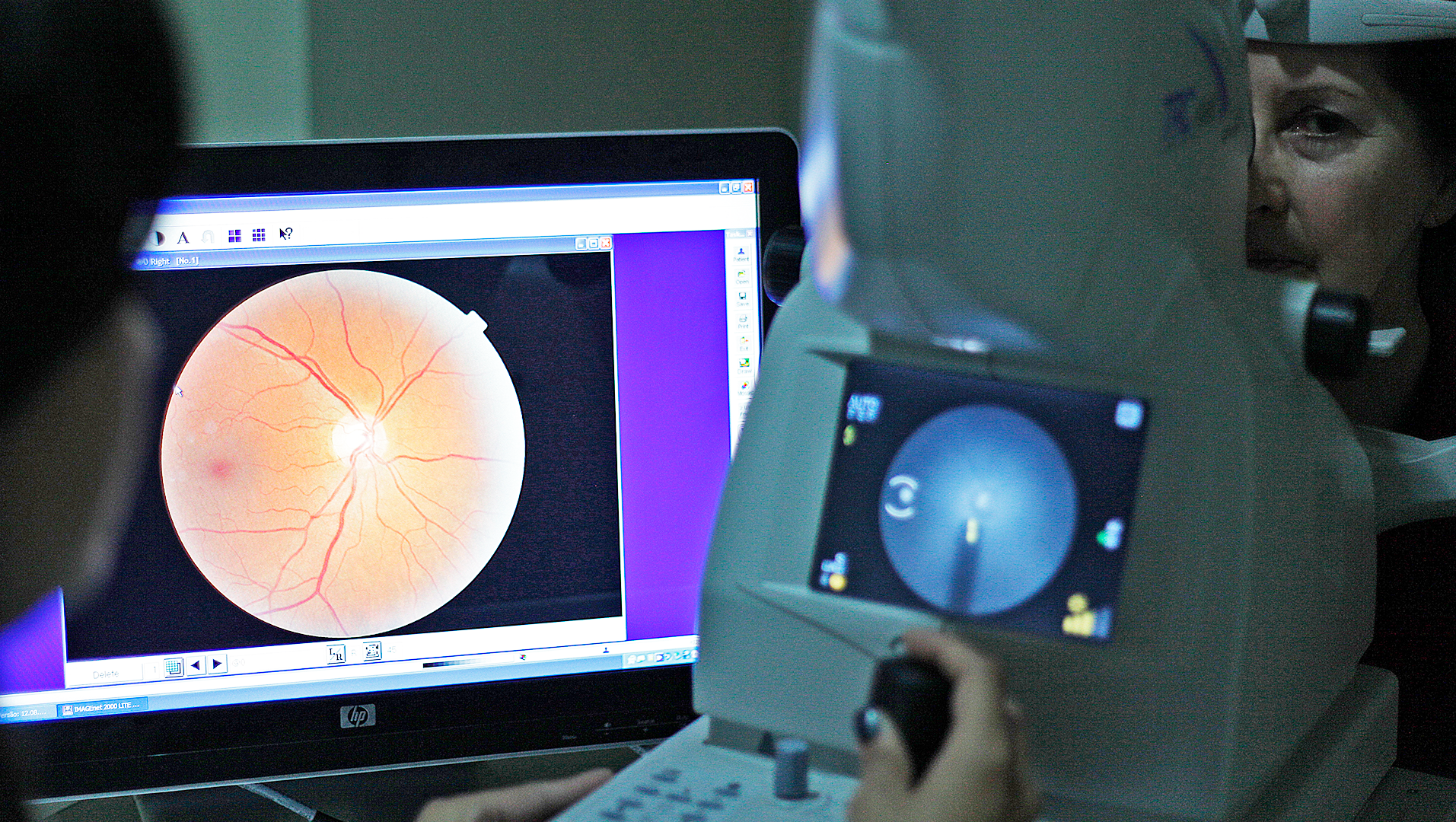exames de imagem da retina